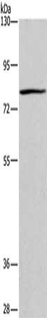 Gel: 6%SDS-PAGE, Lysate: 40 μg, Lane: Raji cells, Primary antibody: BCL6 Antibody(BCL6 Antibody) at dilution 1/100, Secondary antibody: Goat anti rabbit IgG at 1/8000 dilution, Exposure time: 10 seconds