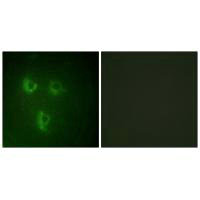 Immunofluorescence analysis of HUVEC cells, using TMEPA antibody.Rabbit anti-Human PMEPA1 Polyclonal Antibody