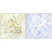 Immunohistochemistry analysis of paraffin-embedded human prostate tissue using TMEPA antibody.Rabbit anti-Human PMEPA1 Polyclonal Antibody