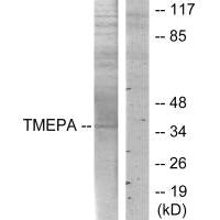 Western blot analysis of extracts from HT-29 cells, using TMEPA antibody.Rabbit anti-Human PMEPA1 Polyclonal Antibody