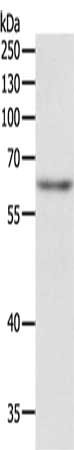 Gel: 10%SDS-PAGE, Lysate: 40 μg, Lane: Jurkat cells, Primary antibody: TRAF3IP2 Antibody(TRAF3IP2 Antibody) at dilution 1/500, Secondary antibody: Goat anti rabbit IgG at 1/8000 dilution, Exposure time: 40 secondsRabbit anti-Human TRAF3IP2 Polyclonal Antibody