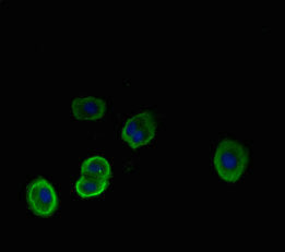 Immunofluorescent analysis of HepG2 cells using NEU1 Antibody at dilution of 1:100 and Alexa Fluor 488-congugated AffiniPure Goat Anti-Rabbit IgG(H+L)Rabbit anti-Human NEU1 Polyclonal Antibody