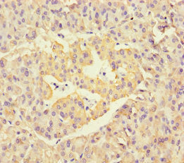 Immunohistochemistry of paraffin-embedded human pancreatic tissue using NEU1 Antibody at dilution of 1:100Rabbit anti-Human NEU1 Polyclonal Antibody