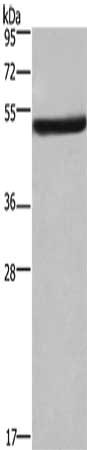 Gel: 8%SDS-PAGE, Lysate: 40 μg, Lane: Mouse kidney tissue, Primary antibody: EIF3F Antibody(EIF3F Antibody) at dilution 1/300, Secondary antibody: Goat anti rabbit IgG at 1/8000 dilution, Exposure time: 2 minutesRabbit anti-Human EIF3F Polyclonal Antibody