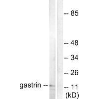 Western blot analysis of extracts from NIH/3T3 cells, using Gastrin antibody.Rabbit anti-Human GAST Polyclonal Antibody