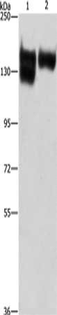 Gel: 6%SDS-PAGE, Lysate: 40 μg, Lane 1-2: A172 cells, human leiomyosarcoma tissue, Primary antibody: ITGB1 Antibody(ITGB1 Antibody) at dilution 1/287.5, Secondary antibody: Goat anti rabbit IgG at 1/8000 dilution, Exposure time: 15 seconds