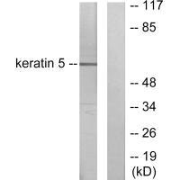 Western blot analysis of extracts from HepG2 cells, using Keratin 5 antibody.