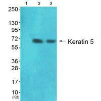 Western blot analysis of extracts from 293 cells (Lane 2) and HepG2 cells (Lane 3), using Keratin 5 antiobdy. The lane on the left is treated with synthesized peptide.