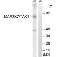 Western blot analysis of extracts from Jurkat cells, treated with heat shock, using MAP3K7 (Ab-187) antibody.