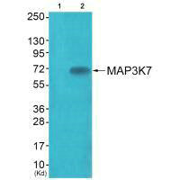 Western blot analysis of extracts from JK cells (Lane 2), using MAP3K7 (Ab-187) antiobdy. The lane on the left is treated with synthesized peptide.
