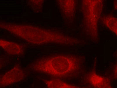 Immunofluorescence staining of methanol-fixed Hela cells using 4E-BP1(Ab-45) Antibody.Rabbit anti-Human EIF4EBP1 Polyclonal Antibody