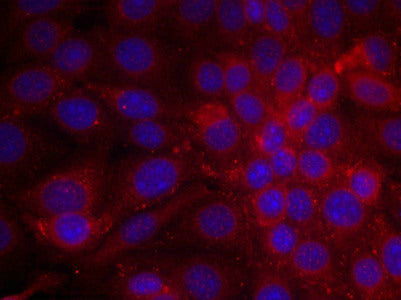 Immunofluorescence staining of methanol-fixed MCF cells using EGFR(Ab-1070) Antibody.Rabbit anti-Human EGFR Polyclonal Antibody