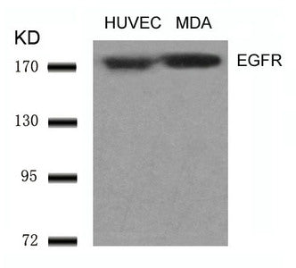Western blot analysis of extracts from HUVEC and MDA cells using EGFR(Ab-1070) Antibody.Rabbit anti-Human EGFR Polyclonal Antibody