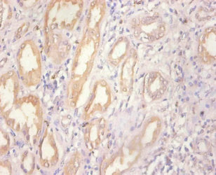 Immunohistochemistry of paraffin-embedded human kidney tissue using MT1A Antibody at dilution of 1:100Rabbit anti-Human MT1A Polyclonal Antibody