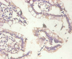Immunohistochemistry of paraffin-embedded human small intestine tissue using MT1A Antibody at dilution of 1:100Rabbit anti-Human MT1A Polyclonal Antibody