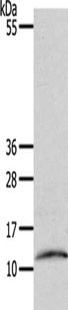Gel: 15%SDS-PAGE, Lysate: 40 μg, Lane: Human fetal muscle tissue, Primary antibody: CCL17 Antibody(CCL17 Antibody) at dilution 1/1100, Secondary antibody: Goat anti rabbit IgG at 1/8000 dilution, Exposure time: 45 secondsRabbit anti-Human CCL17 Polyclonal Antibody