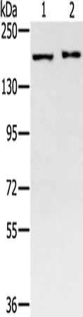 Gel: 6%SDS-PAGE, Lysate: 40 μg, Lane 1-2: 231 cells, K562 cells, Primary antibody: SMC4 Antibody(SMC4 Antibody) at dilution 1/400, Secondary antibody: Goat anti rabbit IgG at 1/8000 dilution, Exposure time: 4 minutesRabbit anti-Human SMC4 Polyclonal Antibody