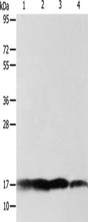 Gel: 12%SDS-PAGE, Lysate: 40 μg, Lane 1-4: Human fetal brain tissue, 293T cells, mouse intestinum tenue tissue, lovo cells, Primary antibody: ATP5J Antibody(ATP5J Antibody) at dilution 1/300, Secondary antibody: Goat anti rabbit IgG at 1/8000 dilution, Exposure time: 1 minute