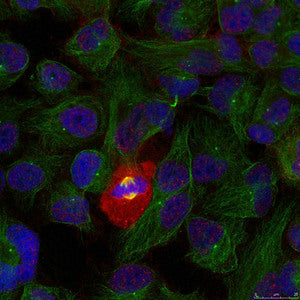 Immunofluorescence staining of methanol-fixed Hela using NFkB-p65(Phospho-Thr254) Antibody.Rabbit anti-Human RELA Polyclonal Antibody