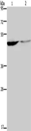Gel: 8%SDS-PAGE, Lysate: 40 μg, Lane 1-2: Human paraneoplastic tissue, Human normal kidney tissue, Primary antibody: KCNK9 Antibody(KCNK9 Antibody) at dilution 1/650, Secondary antibody: Goat anti rabbit IgG at 1/8000 dilution, Exposure time: 40 seconds