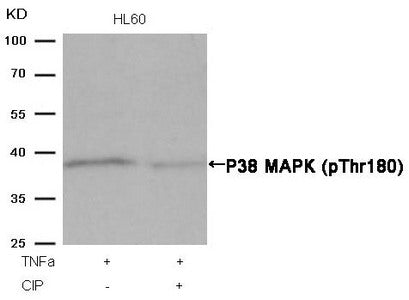 Western blot analysis of extracts from HL60 cells, treated with TNFa or calf intestinal phosphatase (CIP), using P38 MAPK (Phospho-Thr180) Antibody.