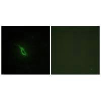 Immunofluorescence analysis of NIH/3T3 cells, using Adrenergic Receptor α-2A antibody.Rabbit anti-Human ADRA2A Polyclonal Antibody