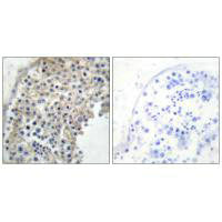 Immunohistochemistry analysis of paraffin-embedded human testis tissue using Adrenergic Receptor α-2A antibody.Rabbit anti-Human ADRA2A Polyclonal Antibody
