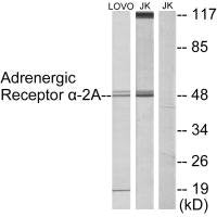 Western blot analysis of extracts from LOVO cells and Jurkat cells, using Adrenergic Receptor α-2A antibody.