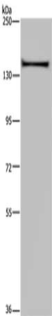 Gel: 6%SDS-PAGE, Lysate: 40 μg, Lane: A549 cells, Primary antibody: KIF1C Antibody(KIF1C Antibody) at dilution 1/200, Secondary antibody: Goat anti rabbit IgG at 1/8000 dilution, Exposure time: 20 seconds