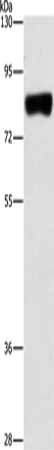 Gel: 8%SDS-PAGE, Lysate: 40 μg, Lane: Hela cells, Primary antibody: ARHGAP25 Antibody(ARHGAP25 Antibody) at dilution 1/500, Secondary antibody: Goat anti rabbit IgG at 1/8000 dilution, Exposure time: 3 minutesRabbit anti-Human ARHGAP25 Polyclonal Antibody
