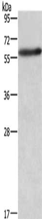 Gel: 6%SDS-PAGE, Lysate: 40 μg, Lane: A172 cells, Primary antibody: AMIGO2 Antibody(AMIGO2 Antibody) at dilution 1/597, Secondary antibody: Goat anti rabbit IgG at 1/8000 dilution, Exposure time: 5 secondsRabbit anti-Human AMIGO2 Polyclonal Antibody