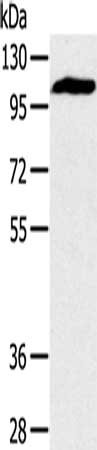 Gel: 8%SDS-PAGE, Lysate: 40 μg, Lane: Mouse heart tissue, Primary antibody: PYGM Antibody(PYGM Antibody) at dilution 1/400, Secondary antibody: Goat anti rabbit IgG at 1/8000 dilution, Exposure time: 40 secondsRabbit anti-Human PYGM Polyclonal Antibody