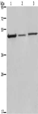 Gel: 8%SDS-PAGE, Lysate: 40 μg, Lane 1-3: 293T cells, mouse brain tissue, A375 cells, Primary antibody: DCTN2 Antibody(DCTN2 Antibody) at dilution 1/200, Secondary antibody: Goat anti rabbit IgG at 1/8000 dilution, Exposure time: 20 secondsRabbit anti-Human DCTN2 Polyclonal Antibody