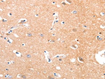 The image on the left is immunohistochemistry of paraffin-embedded Human brain tissue using the antibody Antibody) at dilution 1/50, on the right is treated with synthetic peptide. (Original magnification: ×200)