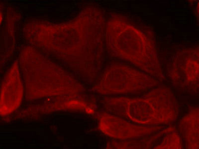 Immunofluorescence staining of methanol-fixed MCF7 cells using p70 S6 Kinase(Phospho-Ser411) Antibody.Rabbit anti-Human RPS6KB1 Polyclonal Antibody
