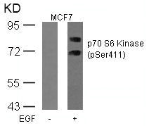 Western blot analysis of extracts from MCF cells untreated or treated with EGF using p70 S6 Kinase(Phospho-Ser411) Antibody.Rabbit anti-Human RPS6KB1 Polyclonal Antibody