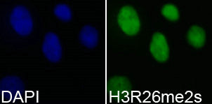 Immunofluorescence analysis of 293T cell using H3R26me2s antibody. Blue: DAPI for nuclear staining.Rabbit anti-Human HIST3H3 Polyclonal Antibody
