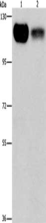 Gel: 6%SDS-PAGE, Lysate: 40 μg, Lane 1-2: 293T cells, NIH/3T3 cells, Primary antibody: PRKD1 Antibody(PRKD1 Antibody) at dilution 1/550, Secondary antibody: Goat anti rabbit IgG at 1/8000 dilution, Exposure time: 30 secondsRabbit anti-Human PRKD1 Polyclonal Antibody