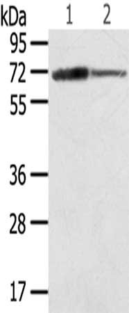 Gel: 8%SDS-PAGE,Lysate: 40 μg,Lane 1-2: Mouse heart tissue, Mouse brain tissue,Primary antibody: SDHA Antibody(SDHA Antibody) at dilution 1/600 dilution,Secondary antibody: Goat anti rabbit IgG at 1/8000 dilution,Exposure time: 5 secondsRabbit anti-Human SDHA Polyclonal Antibody