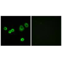 Immunofluorescence analysis of MCF-7 cells, using Cytochrome c-type Heme Lyase antibody.Rabbit anti-Human HCCS Polyclonal Antibody
