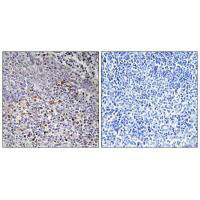 Immunohistochemistry analysis of paraffin-embedded human tonsil tissue using Cytochrome c-type Heme Lyase antibody.Rabbit anti-Human HCCS Polyclonal Antibody