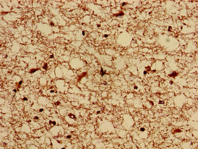 IHC image of KAT5 Antibody diluted at 1:800 and staining in paraffin-embedded human brain tissue performed on a Leica BondTM system. After dewaxing and hydration, antigen retrieval was mediated by high pressure in a citrate buffer (pH 6.0). Section was blocked with 10% normal goat serum 30min at RT. Then primary antibody (1% BSA) was incubated at 4°C overnight. The primary is detected by a biotinylated secondary antibody and visualized using an HRP conjugated SP system.