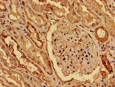 IHC image of KAT5 Antibody diluted at 1:800 and staining in paraffin-embedded human kidney tissue performed on a Leica BondTM system. After dewaxing and hydration, antigen retrieval was mediated by high pressure in a citrate buffer (pH 6.0). Section was blocked with 10% normal goat serum 30min at RT. Then primary antibody (1% BSA) was incubated at 4°C overnight. The primary is detected by a biotinylated secondary antibody and visualized using an HRP conjugated SP system.