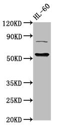 Western Blot | Positive WB detected in: HL60 whole cell lysate | All lanes: KAT5 antibody at 3μg/ml | Secondary | Goat polyclonal to rabbit IgG at 1/50000 dilution | Predicted band size: 59, 54, 62, 57 kDa | Observed band size: 59 kDa