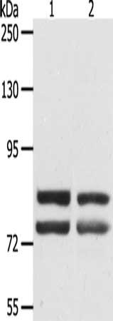 Gel: 8%SDS-PAGE, Lysate: 40 μg, Lane 1-2: SKOV3 cells, hela cells, Primary antibody: DDX4 Antibody(DDX4 Antibody) at dilution 1/300, Secondary antibody: Goat anti rabbit IgG at 1/8000 dilution, Exposure time: 45 secondsRabbit anti-Human DDX4 Polyclonal Antibody