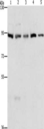Gel: 6%SDS-PAGE, Lysate: 40 μg, Lane 1-5: HepG2 cells, K562 cells, Jurkat cells, 231 cells, hela cells, Primary antibody: MCM5 Antibody(MCM5 Antibody) at dilution 1/300, Secondary antibody: Goat anti rabbit IgG at 1/8000 dilution, Exposure time: 20 seconds