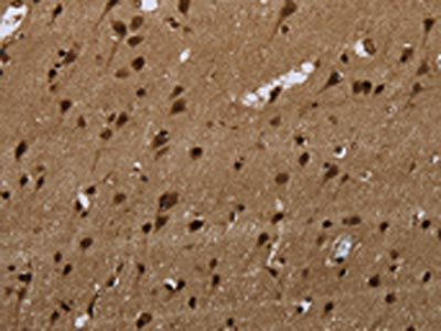 The image on the left is immunohistochemistry of paraffin-embedded Human brain  tissue using ANP32E Antibody(ANP32E Antibody) at dilution 1/20, on the right is treated with synthetic peptide. (Original magnification: ×200)Rabbit anti-Human ANP32E Polyclonal Antibody