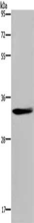 Gel: 10%SDS-PAGE, Lysate: 40 μg, Lane: Mouse thymus tissue, Primary antibody: ANP32E Antibody(ANP32E Antibody) at dilution 1/300, Secondary antibody: Goat anti rabbit IgG at 1/8000 dilution, Exposure time: 20 secondsRabbit anti-Human ANP32E Polyclonal Antibody