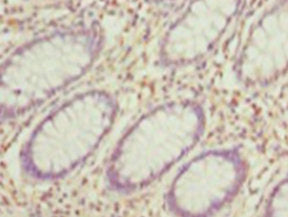 Immunohistochemistry of paraffin-embedded human testis tissue using the antibody at dilution of 1: 100Rabbit anti-Human HDAC1 Polyclonal Antibody