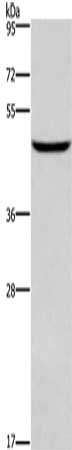 Gel: 8%SDS-PAGE, Lysate: 40 μg, Lane: Human testis tissue, Primary antibody: DMRT3 Antibody(DMRT3 Antibody) at dilution 1/550, Secondary antibody: Goat anti rabbit IgG at 1/8000 dilution, Exposure time: 20 secondsRabbit anti-Human DMRT3 Polyclonal Antibody